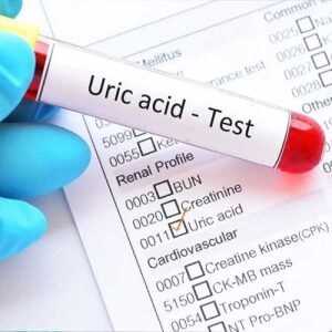 Uric Acid Test Costs in Dubai